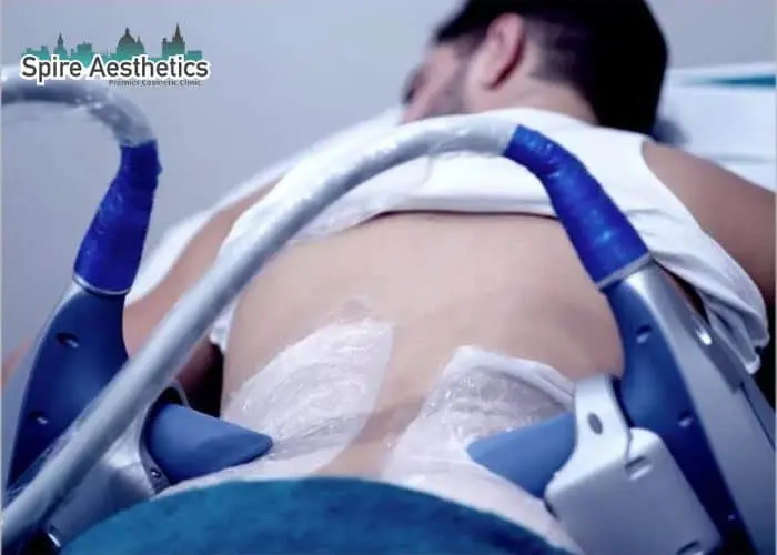 Man having fat freezing treatment done on love handles before a competitions Spring Bank to create a sculpted look.